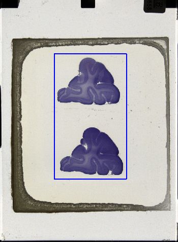 Media type: image; Special Collections 3043   shows specimen_part histological serial section;